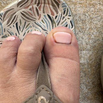 Pure Escape Beauty Bar - Infection starting on big toe - Nail Salons Near Me - Anaheim, California Pure Escape Beauty Bar - Infection starting on big toe - Nail Salons Near Me - Anaheim, California