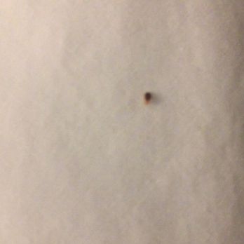 Hampton Inn & Suites Cincinnati / Kenwood - Bedbugs at this hotel that sent me to ER - Hotels Near Me - Cincinnati, Ohio Hampton Inn & Suites Cincinnati / Kenwood - Bedbugs at this hotel that sent me to ER - Hotels Near Me - Cincinnati, Ohio