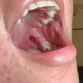 Mint Dental and Orthodontics - Abrasion left on my nieces mouth due to Dr. Bibiana's aggressiveness - Orthodontists Near Me - Henderson, Nevada Mint Dental and Orthodontics - Abrasion left on my nieces mouth due to Dr. Bibiana's aggressiveness - Orthodontists Near Me - Henderson, Nevada