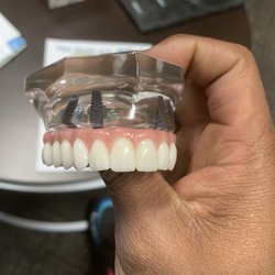 Nj Team Dental Center - Team dental stated that a snap in denture was my only option that's not wat was told to me else where