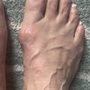 Precision Foot and Ankle Centers