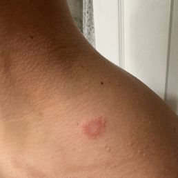 Be cautious both of my nephews have ringworm from playing at the trampoline park. I notified the team so that they can do a cleaning. Be cautious both of my nephews have ringworm from playing at the trampoline park. I notified the team so that they can do a cleaning.