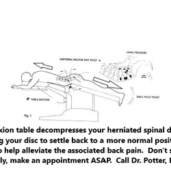 Jeffery B Potter, DC - Tomball Family Chiropractic - Decompression to help alleviate herniate disc pain.