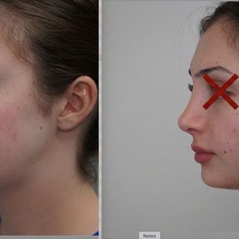 Vladimir Grigoryants, MD - Cosmetic Surgeons Near Me - Glendale, California Vladimir Grigoryants, MD - Cosmetic Surgeons Near Me - Glendale, California