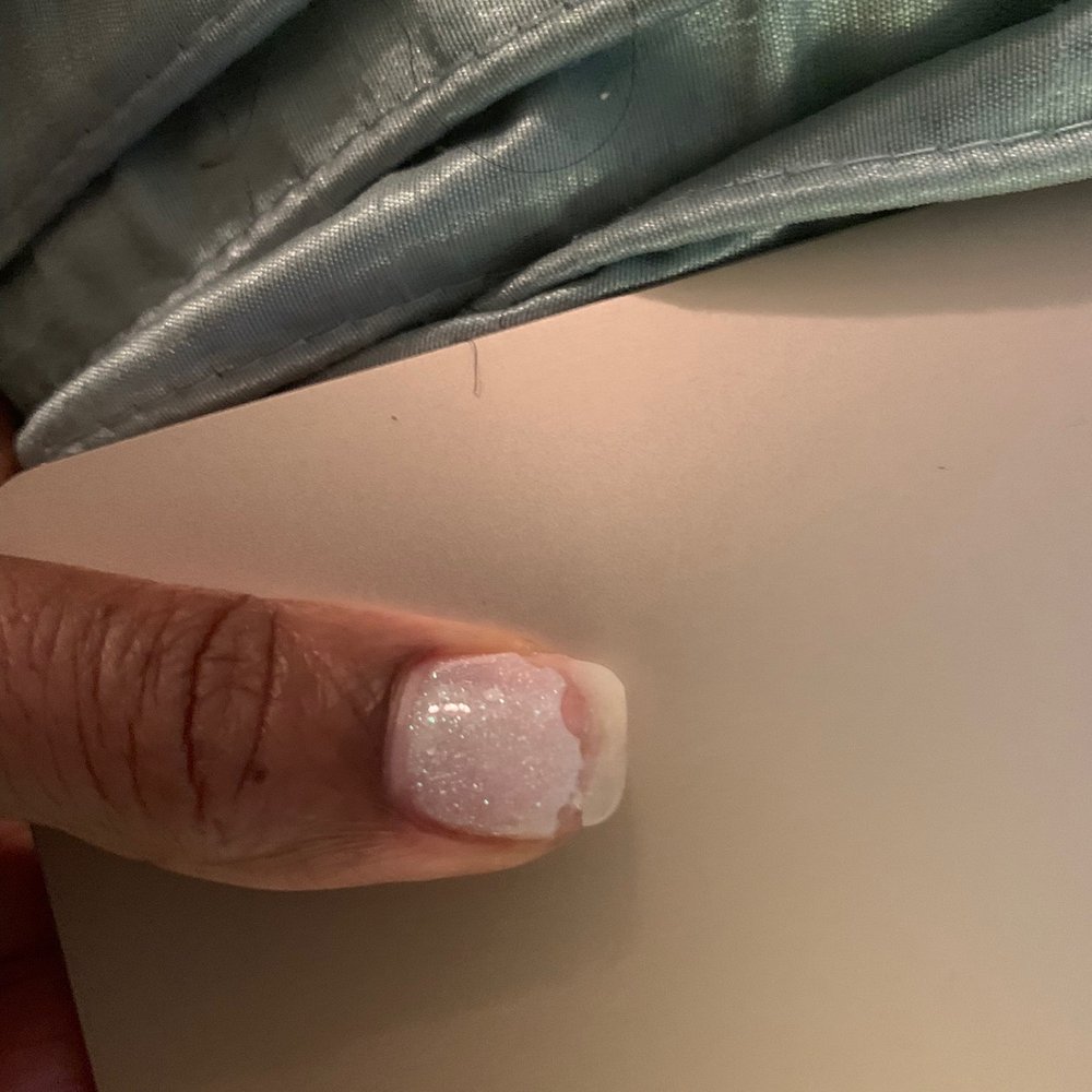 VIP Nails & Spa - Thumb mail separated and gel broke off. - Nail Salons Near Me - Apopka, Florida VIP Nails & Spa - Thumb mail separated and gel broke off. - Nail Salons Near Me - Apopka, Florida