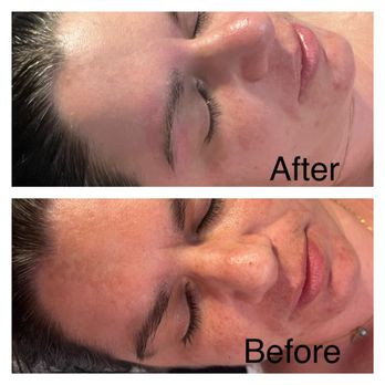 Serenity Aesthetics - Before and After photos Service : Serenity Facial and Eyebrow Wax/ Lip Wax - Day Spas Near Me - Oakhurst, California Serenity Aesthetics - Before and After photos Service : Serenity Facial and Eyebrow Wax/ Lip Wax - Day Spas Near Me - Oakhurst, California
