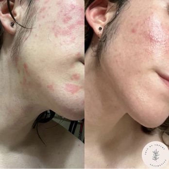 Skin by Shelby Aesthetics - Estheticians Near Me - Phoenix, Arizona