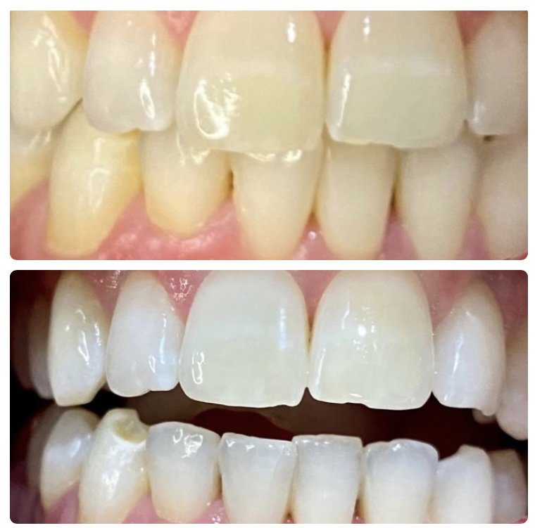 Diamond Dental Hygiene