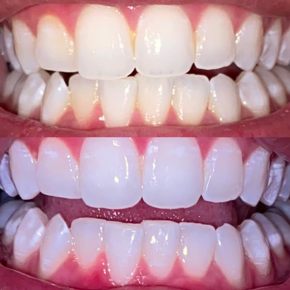 Illuminate Smile Specialists Logo