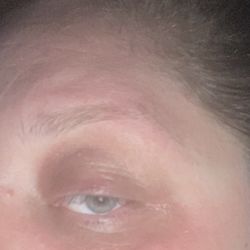 The corner of my eyebrow is GONE
