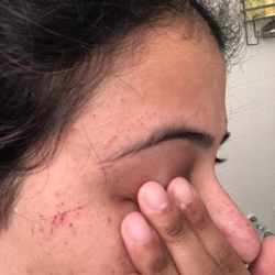 Hemali's Touch Beauty Studio - How a simple visit for face waxing, left my face two days later