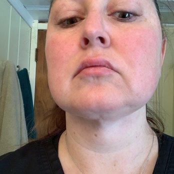 Rhee Plastic Surgery - My neck actually looks worse now just like my 65 year old mothers - Plastic Surgeons Near Me - Paramus, New Jersey