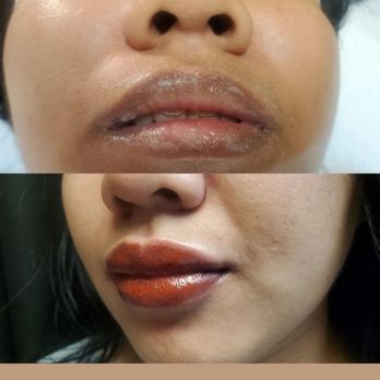 Permanently Beautiful Solutions - FULL LIP COLOR TATTOOING - Permanent Makeup Near Me - Huntington Beach, California Permanently Beautiful Solutions - FULL LIP COLOR TATTOOING - Permanent Makeup Near Me - Huntington Beach, California