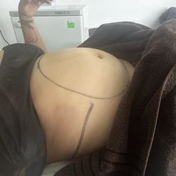 BodyCare Liposculpture & Anti-Aging Clinic