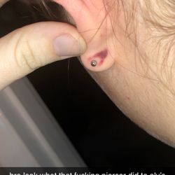 Paris Ink - Ear clamp bruise