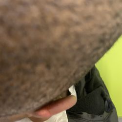 Children's Urgent Care - Chamblee - The cut the second it wasn't bleeding