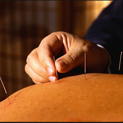 E. W. Natural Healing Acupuncture, PC