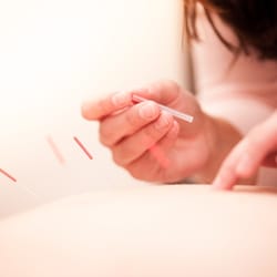 Eleonora A Bowers, MS, LAc - Needling