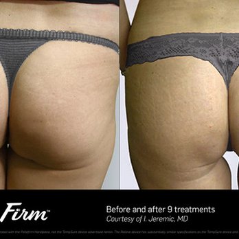 opulence glutathione review 2017 MEDICAL SPA - CLOSED - Updated September 2026 - 16 Photos - 1525 Franklin St, San Francisco, California - Medical Spas - Phone Number ISHIN is FDA Approved