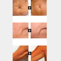 My Body Center - Nos résultats