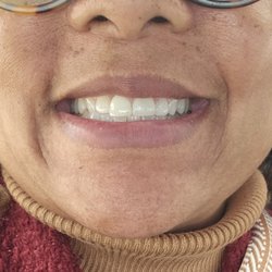 Burton Dentistry