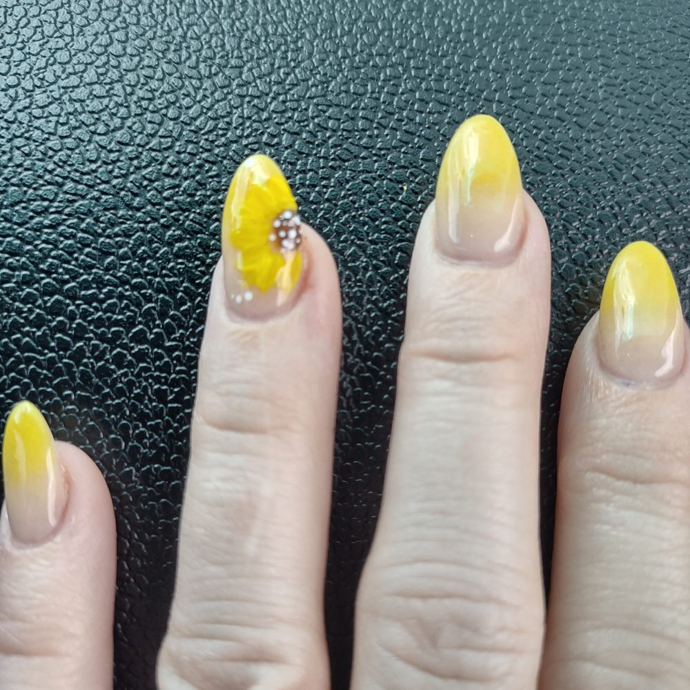 lemon bottle fat dissolving course near me Before and after sessions of lemon bottles dissolving