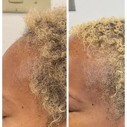 California Aesthetics Hair Restoration and IV Therapy