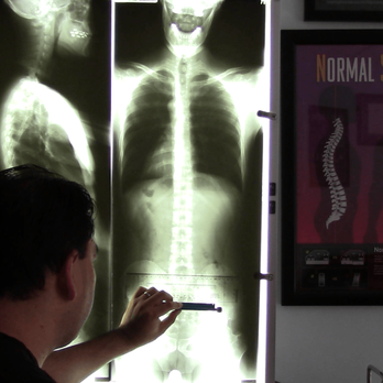 Specific Chiropractic - Gonstead Xray Analysis of the full spine. - Chiropractors Near Me - New York, New York Specific Chiropractic - Gonstead Xray Analysis of the full spine. - Chiropractors Near Me - New York, New York