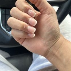 Infinite Beauty - Contact dermatitis