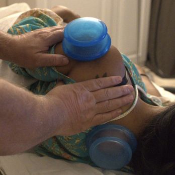 Ricky Prevatte Massage - Ricky Prevatte, cupping of shoulder and neck area with silicone cups - Massage Therapy Near Me - Rock Hill, South Carolina Ricky Prevatte Massage - Ricky Prevatte, cupping of shoulder and neck area with silicone cups - Massage Therapy Near Me - Rock Hill, South Carolina