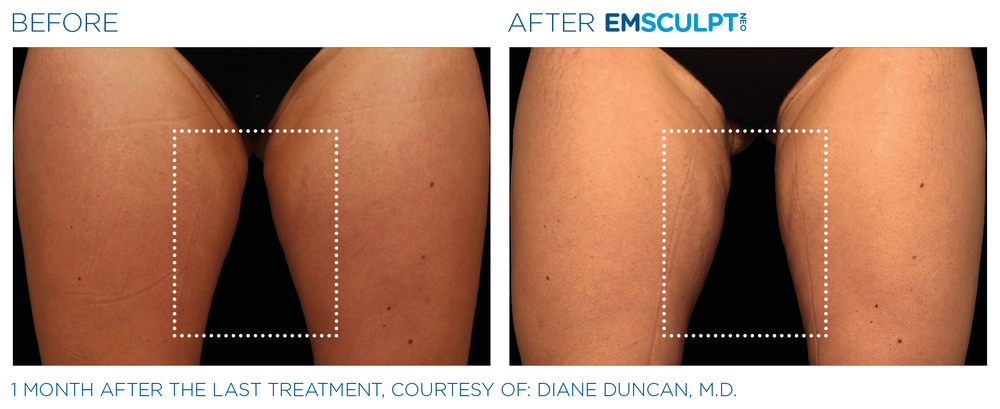 Mill Creek Skin & Laser Coolsculpting Center Logo