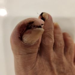 Escape Nail Salon And Spa - Toenails after removing my sock at home.