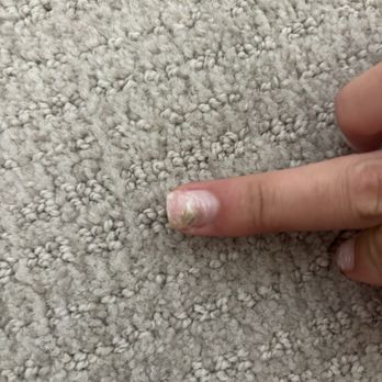 Essential Nail and Spa - FUNGUS! - Nail Salons Near Me - Knoxville, Tennessee Essential Nail and Spa - FUNGUS! - Nail Salons Near Me - Knoxville, Tennessee