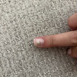 Essential Nail and Spa - FUNGUS!