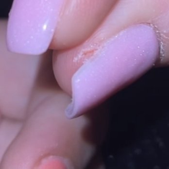 Broadway Nail Bar - Cut on finger - Waxing Near Me - Knoxville, Tennessee Broadway Nail Bar - Cut on finger - Waxing Near Me - Knoxville, Tennessee