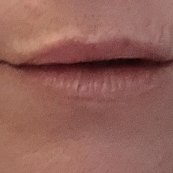 Juvly Aesthetics - Medical Spas Near Me - Chanhassen, Minnesota