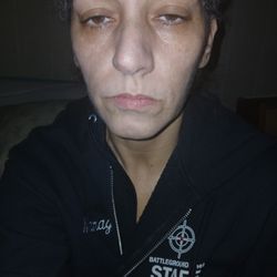 Roger Williams Medical Center - I weighed 147 when this started I weigh 115 look half dead yet I'm not sick.