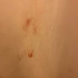 Blood all over the shower curtain