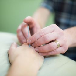 Alpine Acupuncture - Carleton has treated thousands of patients in the Issaquah, Sammamish, Renton and Belleuvue areas over the last ten years!