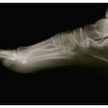 Steven W Pearson, MD - Orthopedists Near Me - Santa Barbara, California