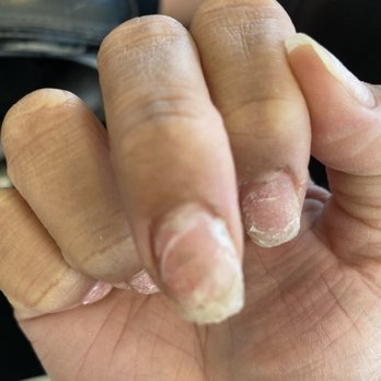 Y2K Nails - My nails corroded with leftover nail and polish in it. After he said he was done - Nail Salons Near Me - Sacramento, California