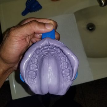 Mouthpiece Guy - Final mold with gum line - Sporting Goods Near Me - Covina, California
