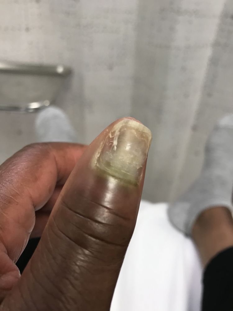 CALI NAILS Updated July 2024 123 Photos & 64 Reviews 1587 E 17th