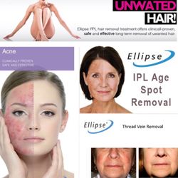 LA Beauty Clinic - Ellipse Laser Services