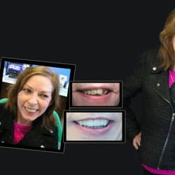 Dr Zenaidy Castro - General & Cosmetic Dentist in Melbourne CBD - Wondering how much would a cosmetic dental surgery costs or cost of cosmetic dentistry in Melbourne?We offer Affordable Dental Payment Plan