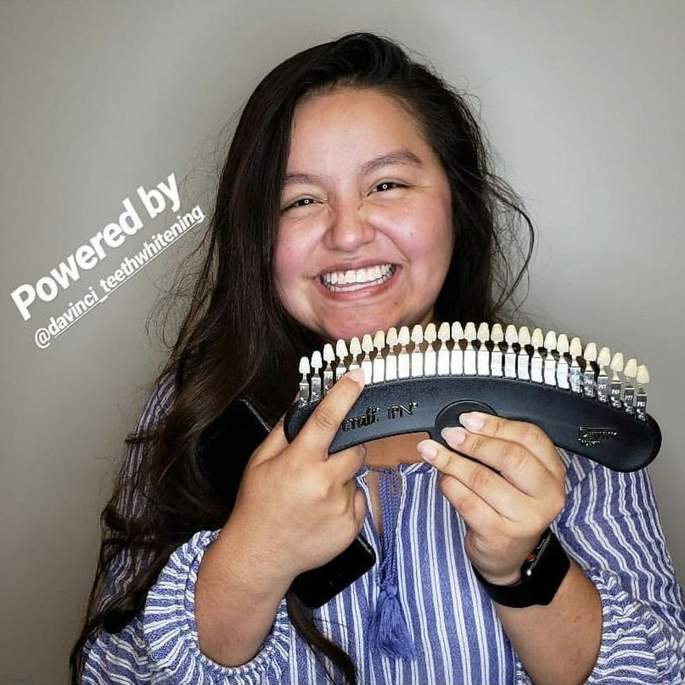 OHANA TEETH WHITENING BY DAVINCI Updated June 2024 28 Photos 1750