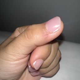 nail