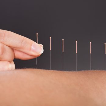 New Universe Acupuncture - Acupuncture Near Me - Pasadena, California New Universe Acupuncture - Acupuncture Near Me - Pasadena, California