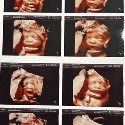 Forever Yours Ultrasound