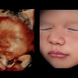 Charlie's Angels Ultrasound